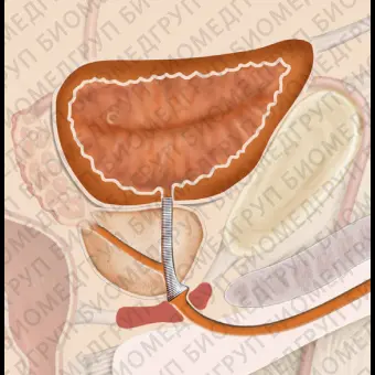 Простатический стент Memokath028