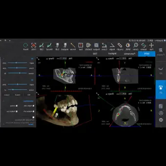 Программное обеспечение для обработки снимков зубов SmartV Pro