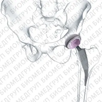Миниинвазивный протез бедра Metha