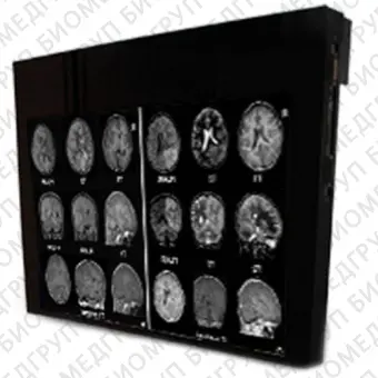 Double Black Imaging 24 MRSafe Display Медицинский монитор