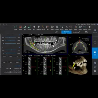 Программное обеспечение для обработки снимков зубов SmartV Pro