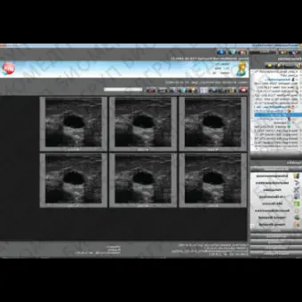 Программное обеспечение для гинекологического обследования NEXUS / OBSTETRICS