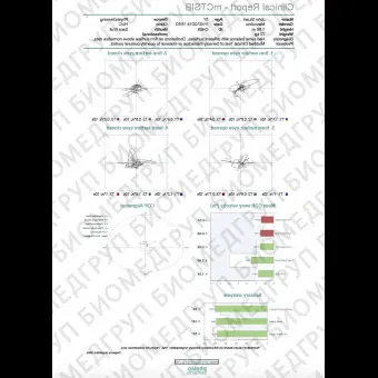 Переносная стабилометрическая платформа PhysioSensing Rehab