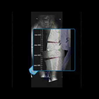 Медицинское программное обеспечение OrthoView