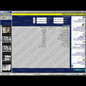 Программное обеспечение для обработки снимков зубов XrayVision