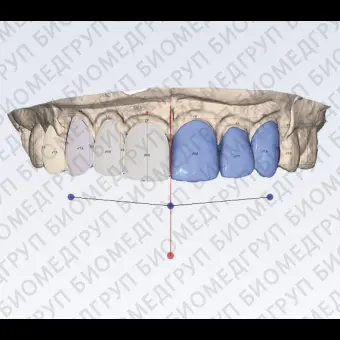 Программное обеспечение для стоматологии Planmeca Romexis Smile Design