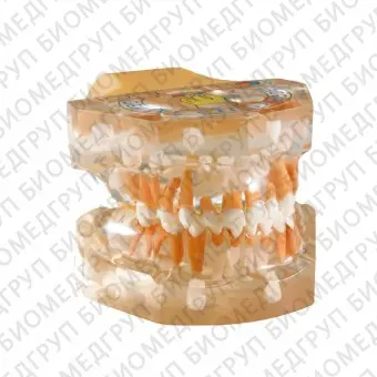 TOOTH MODEL FTYPE  прозрачная модель, демонстрирующая прорезывание зубов