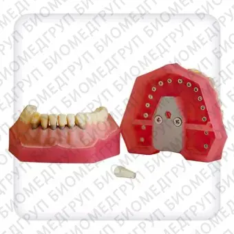 Модель верхней и нижней челюстей с 32 модельными зубами для лечения пародонтоза