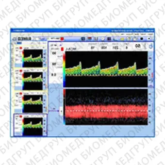 Трансчерепной доплер DigiLite