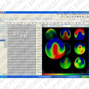 Неврологическое программное обеспечение EEG DigiTrack