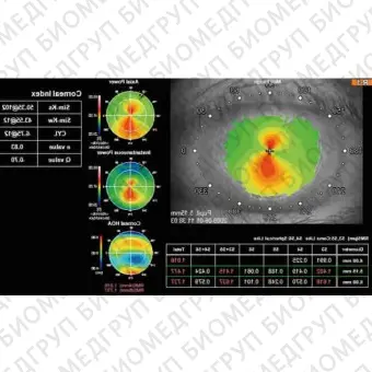 Роговичный топограф KR1W