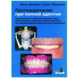 Протезирование при полной адентии / Ю. Дапприх